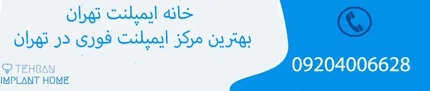 بهترین مرکز ایمپلنت فوری در تهران کجاست؟