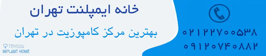 کامپوزیت دندان چیست؟