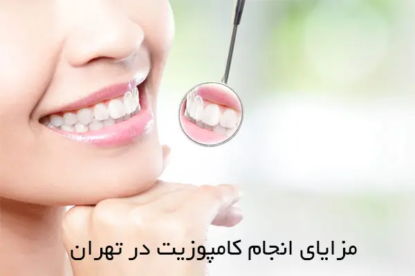 مزایای انجام کامپوزیت در تهران