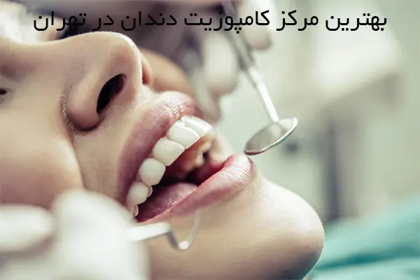 بهترین مرکز کامپوزیت دندان در تهران