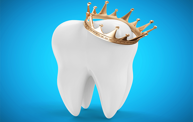 در چه شرایطی استفاده از روکش دندان ضروری است؟
