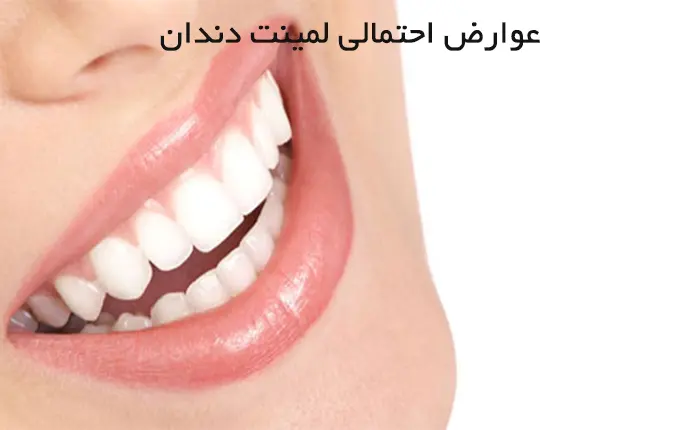 عوارض  لمینت دندان