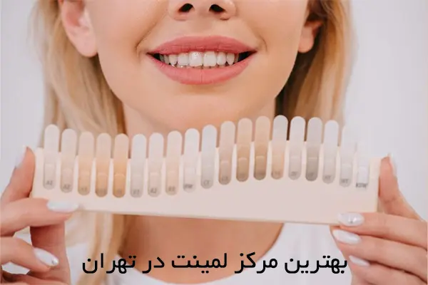 بهترین مرکز لمینت در تهران
