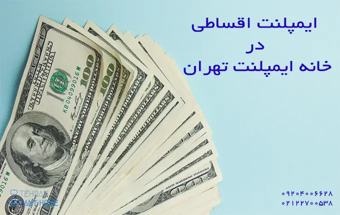 قیمت ایمپلنت اقساطی