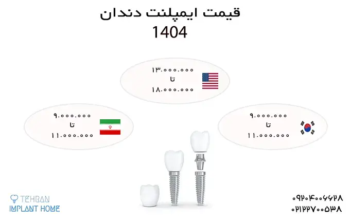قیمت ایمپلنت در سال 1404 در تهران چقدر است ؟