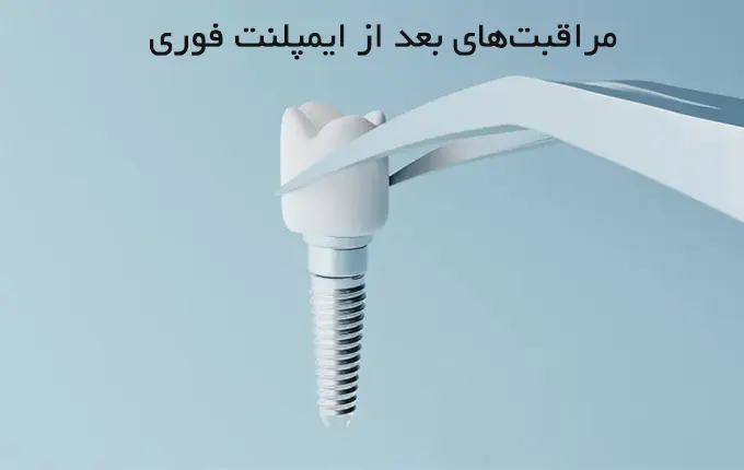 مراقبت‌های بعد از ایمپلنت فوری