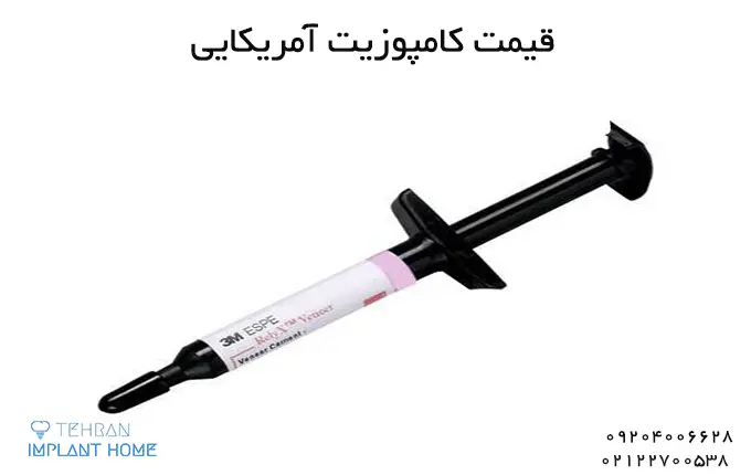 جدول قیمت کامپوزیت دندان 1403