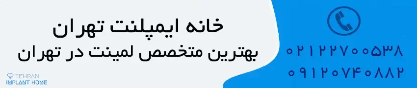 متخصص لمینت در شمال تهران