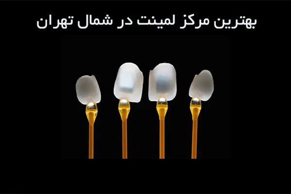 چرا لمینت در شمال تهران؟ 