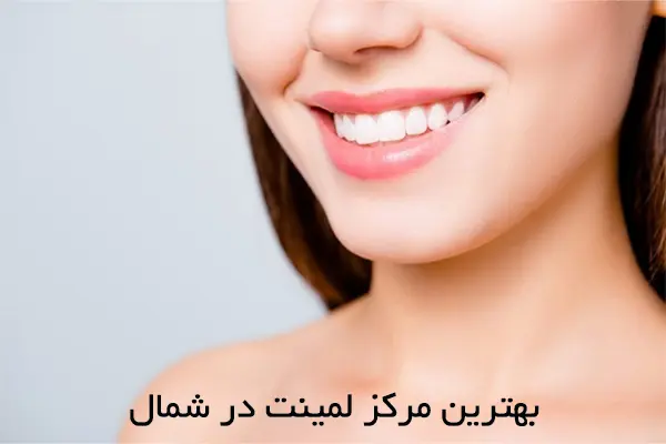 ویژگی‌های بهترین متخصص لمینت در شمال تهران