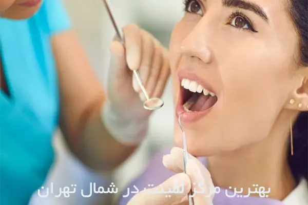 متخصص لمینت در شمال تهران