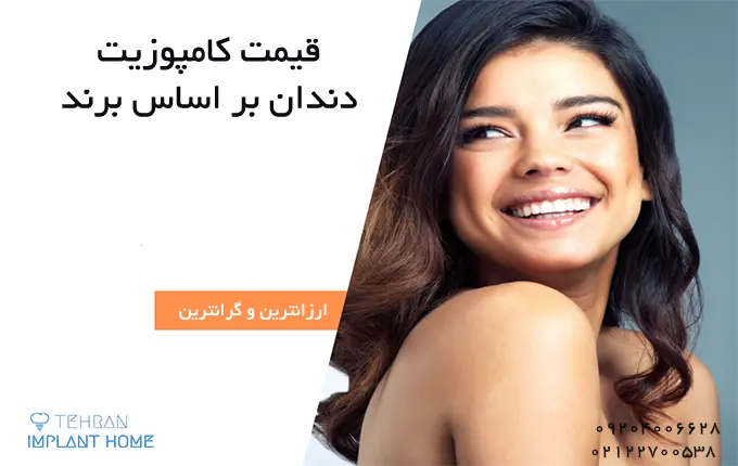 قیمت کامپوزیت دندان بر اساس برند