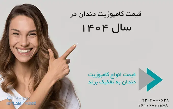 قیمت کامپوزیت دندان در سال 1404 چقدر است ؟