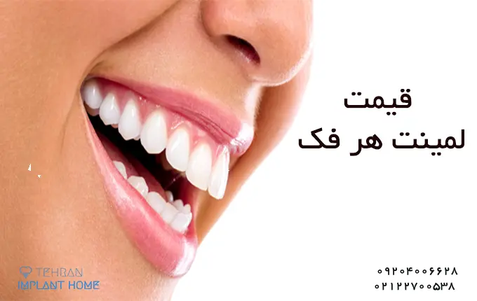 قیمت لمینت هر فک چقدر است ؟