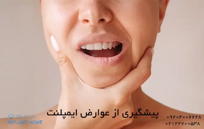 روش های پیشگیری از عوارض کاشت ایمپلنت دندان