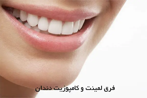 6 فرق لمینت و کامپوزیت دندان که باید بدانید