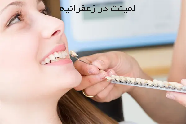 مراحل انجام لمینت دندان در زعفرانیه