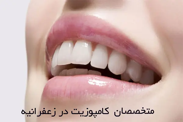 چرا انجام کامپوزیت در زعفرانیه؟