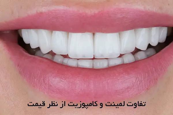 تفاوت قیمت لمینت و کامپوزیت