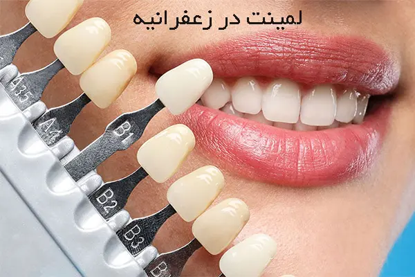 دکتر لمینت در زعفرانیه تهران