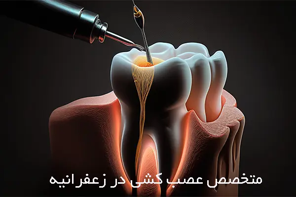 ایمپلنت فوری یا ایمپلنت دو مرحله ای، کدام بهتر است؟