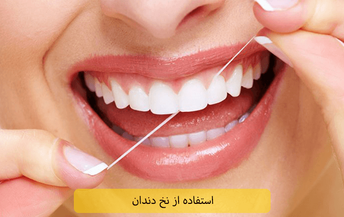 حفظ بهداشت دهان و دندان برای جلوگیری از زرد شدن کامپوزیت دندان