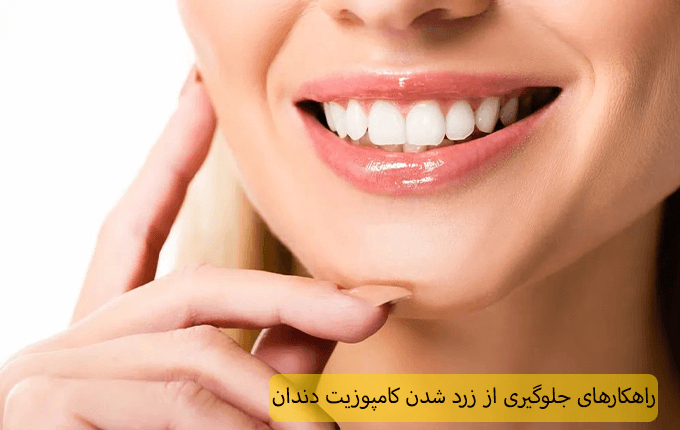 جلوگیری از زرد شدن کامپوزیت دندان