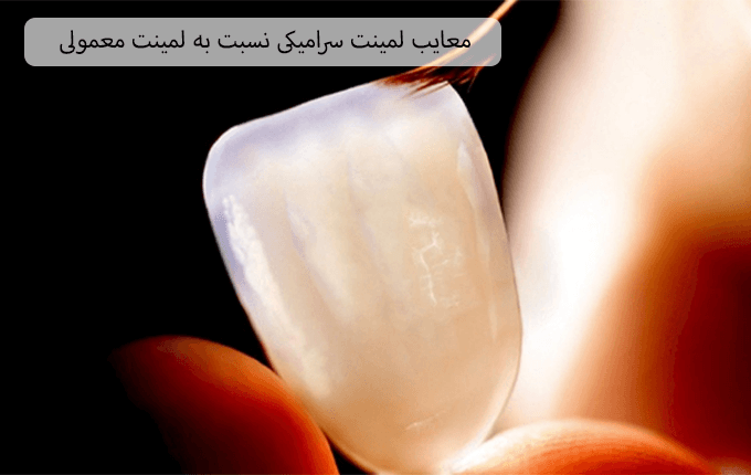 معایب لمینت سرامیکی نسبت به لمینت معمولی