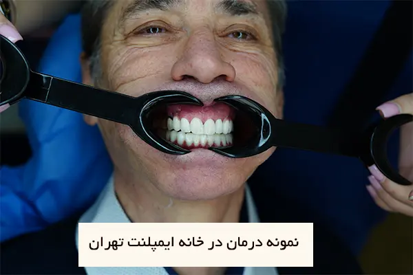 رضایت بیماران از مراجعه به مرکز ایمپلنت در تهران