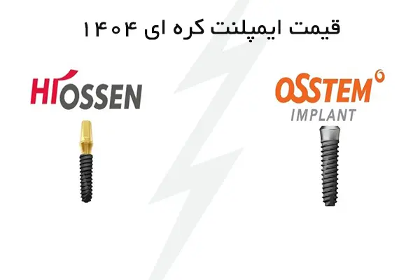 قیمت ایمپلنت کره‌ای در سال ۱۴۰۴