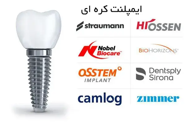 مقایسه برندهای پرفروش ایمپلنت کره‌ ای در خانه ایمپلنت تهران