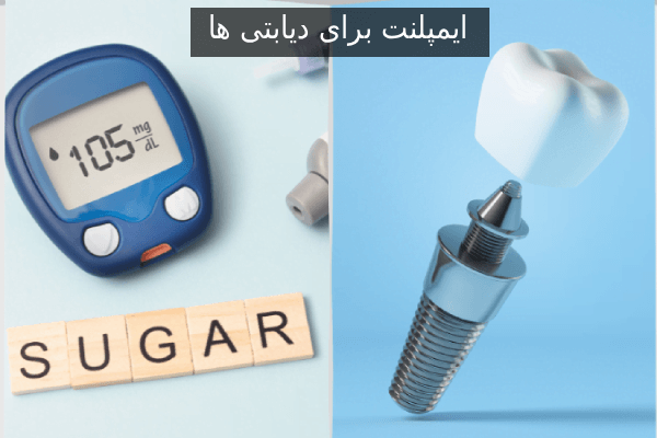 ایمپلنت برای دیابتی ها