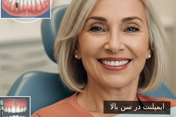 ایمپلنت در سن بالا 