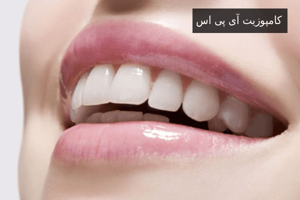 کامپوزیت آی پی اس
