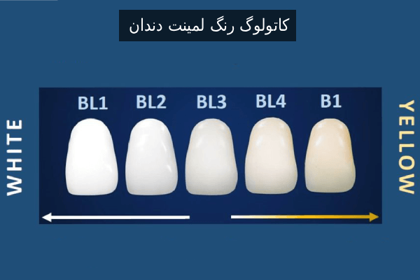 کاتولوگ رنگ لمینت دندان