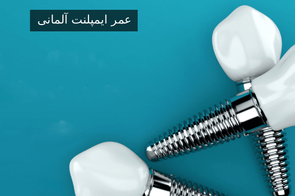 عمر ایمپلنت آلمانی