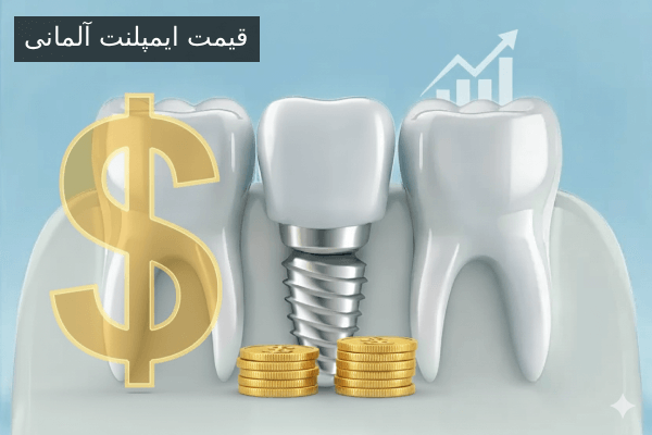 قیمت ایمپلنت آلمانی