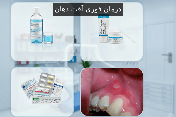 درمان فوری آفت دهان