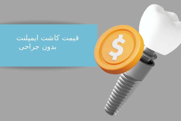 قیمت کاشت ایمپلنت بدون جراحی
