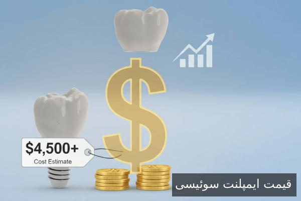 قیمت ایمپلنت سوئیسی 