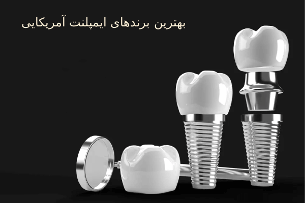بهترین برندهای ایمپلنت آمریکایی 