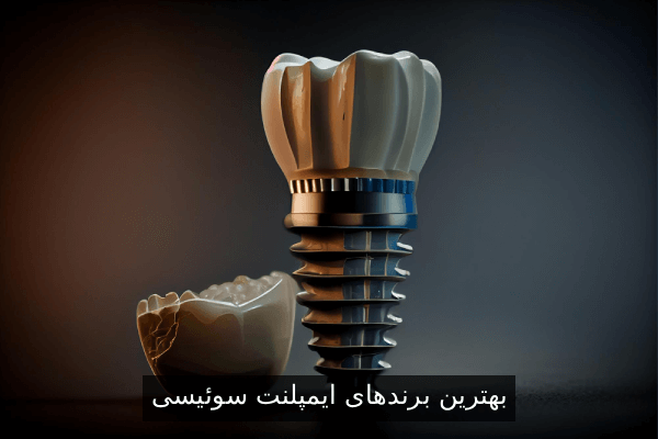 بهترین برندهای ایمپلنت سوئیسی