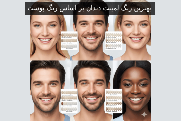 بهترین رنگ لمینت دندان بر اساس رنگ پوست
