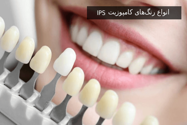 انواع رنگهای کامپوزیت IPS