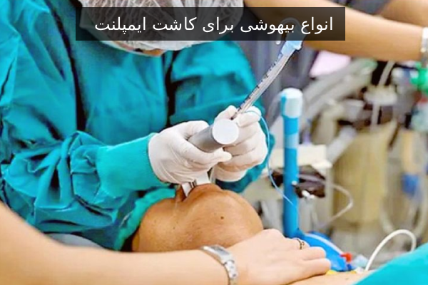 انواع بیهوشی برای کاشت ایمپلنت